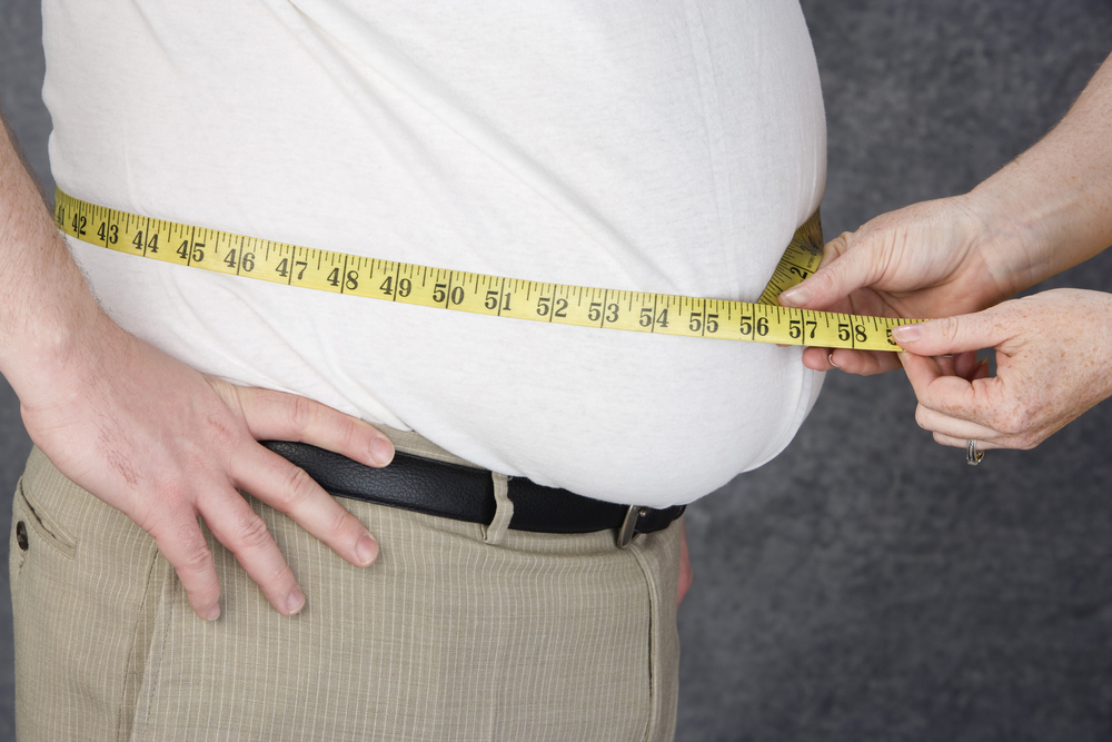 Obesity As A Risk Factor For Advanced Prostate Cancer