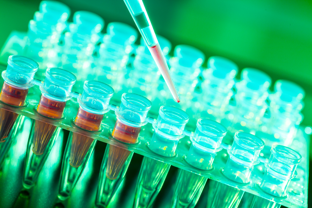 Urine-Based Test Improves Prostate Cancer Detection