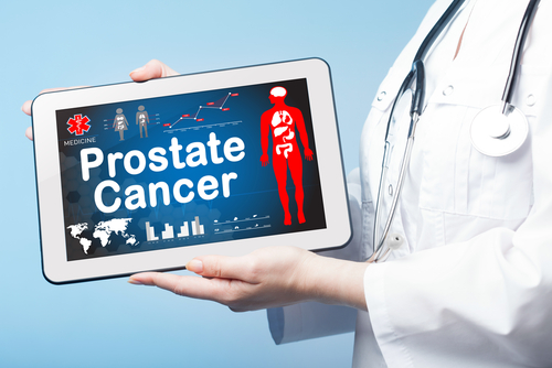 Prostate cancer trial