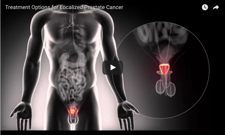 Active Surveillance Better than Surgery or Radiation Therapy for Men at Low Prostate Cancer Risk