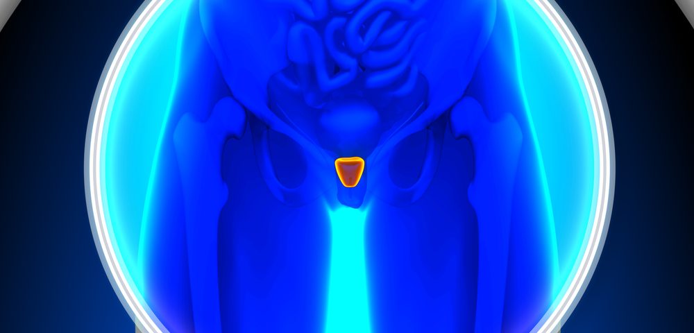 AR Protein in Prostate Cancer Detected with New Imaging Technique