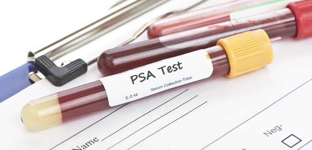 PSA Screenings for Prostate Cancer Continue in US Despite Task Force’s Opposition
