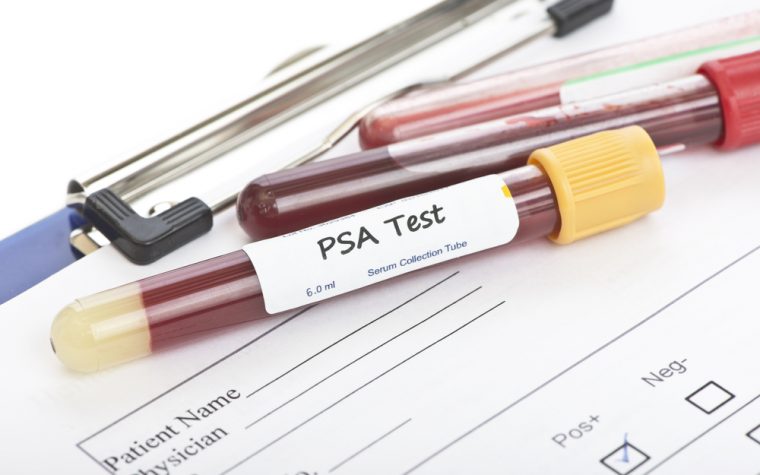 psa screenings for prostate cancer