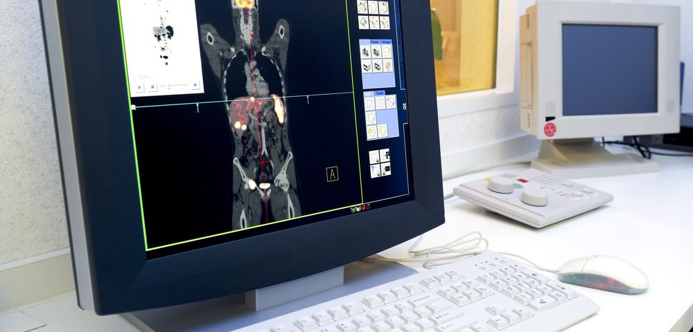 Imaging Agent Able to Detect Early and Advanced Prostate Cancers by Tracking Biomarkers