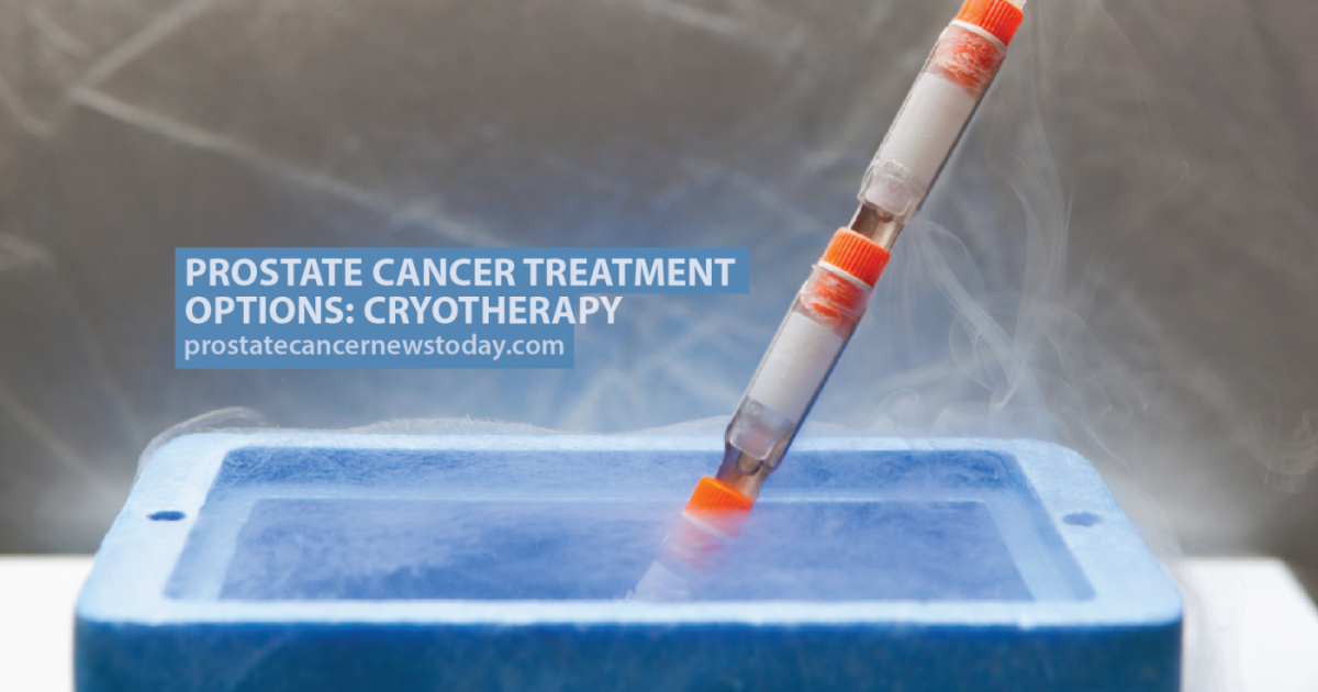 Prostate Cancer Treatment Options Cryotherapy Prostate Cancer News Today 0225
