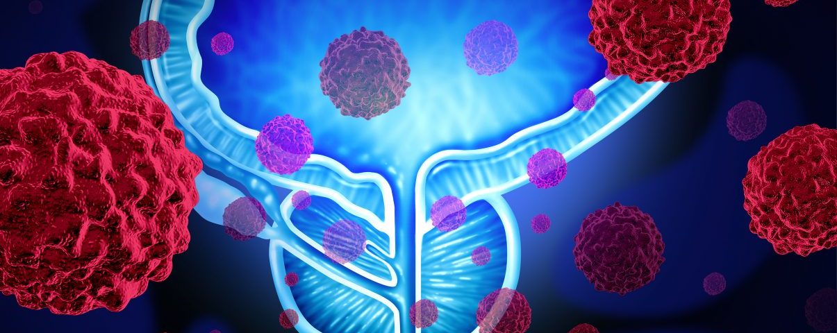 Galeterone Study Sheds Light on Promising Next-Gen Therapies for Advanced Prostate Cancer