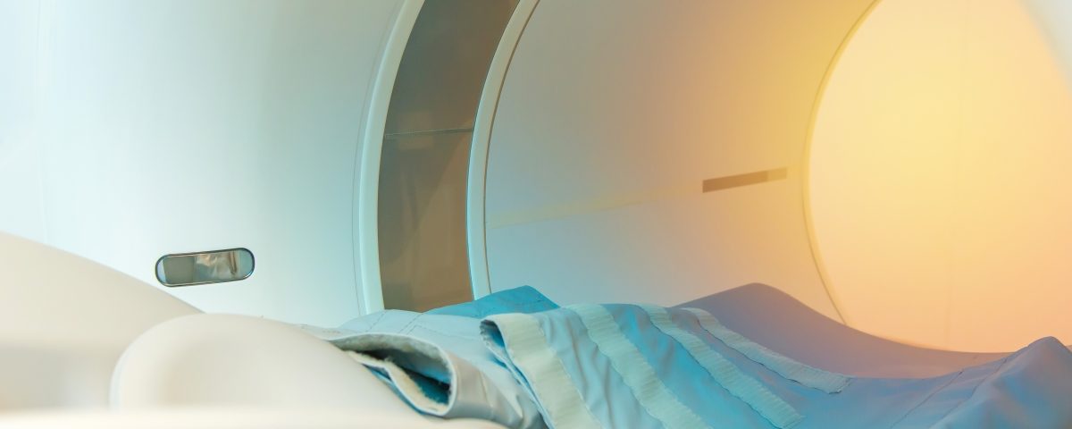 PSMA PET-CT Offers Better Detection Rates in Recurrent PC, Study Says