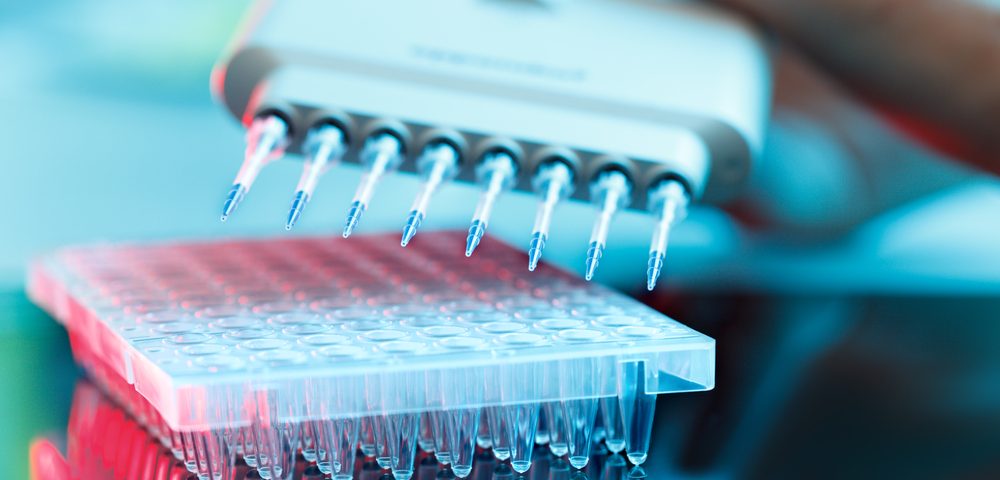 Genomic Health, Janssen Partner to Advance Test Predicting Best Treatment for Low-Risk Prostate Cancer