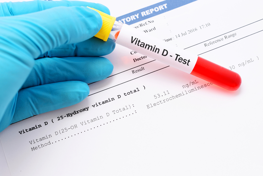 Prostate Cancer Risk Linked to High Vitamin D Levels