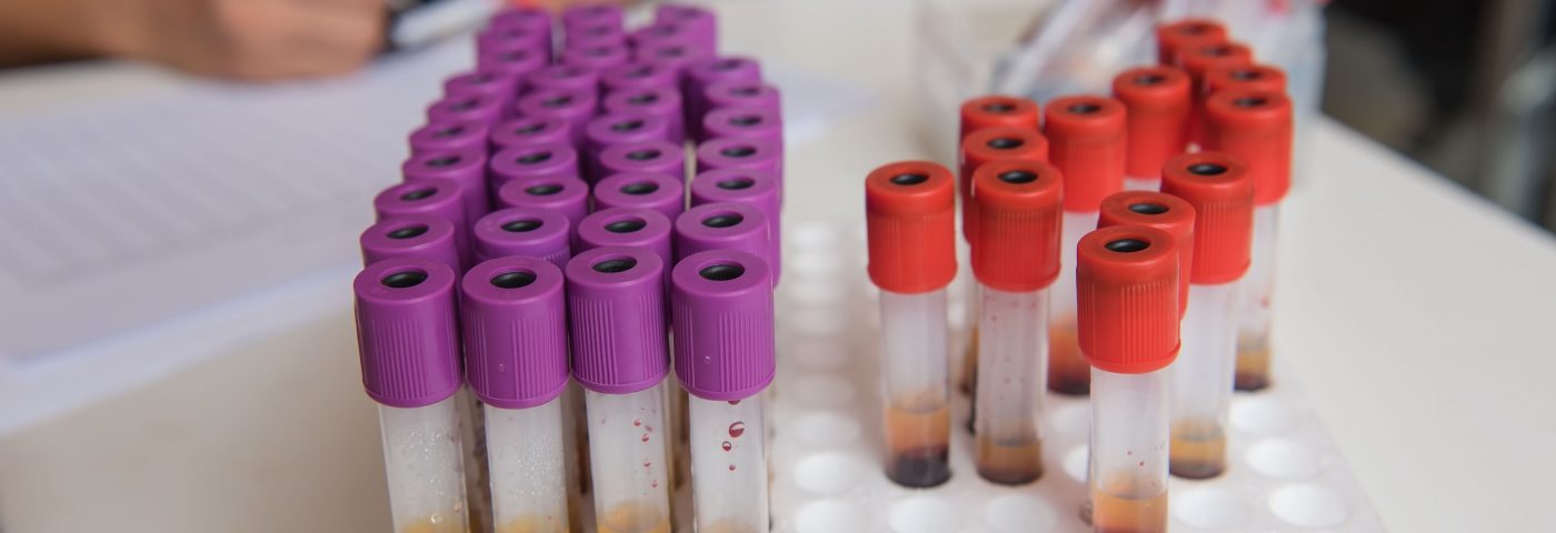 Cancer DNA Levels in Blood Can Predict Treatment Responses